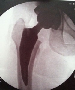 I am Bionic Woman hear me roar!